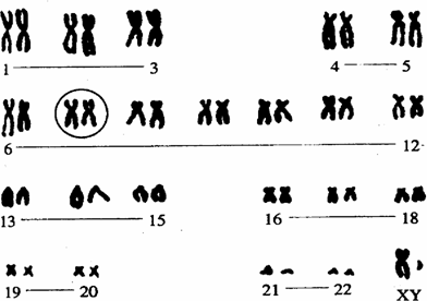 下图为正常男性的染色体分组图